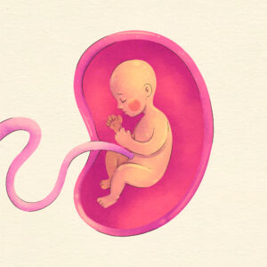 A placenta that begins to pull away from the uterus before delivery is called placental abruption.