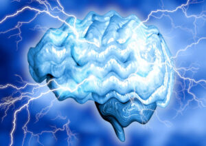 epilepsy as changes in the brain's electrical activity