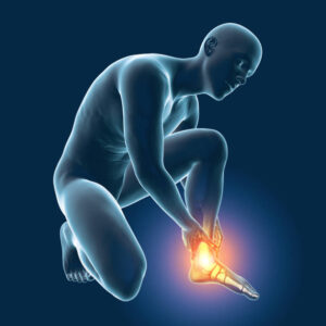 Achilles heel pain