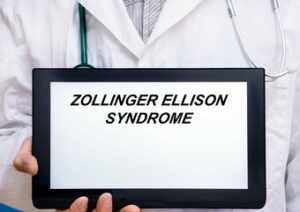 Zollinger-Ellison syndrome