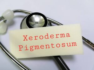 XERODERMA PIGMENTOSUM