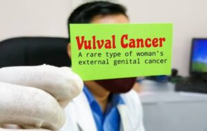 VULVAR CANCER