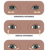 PEYRONIE’S DISEASE Archives - Just Health Hub